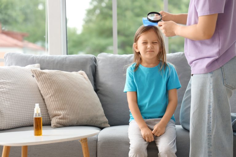 Vinegar Loosens Nits but Won’t Kill Lice