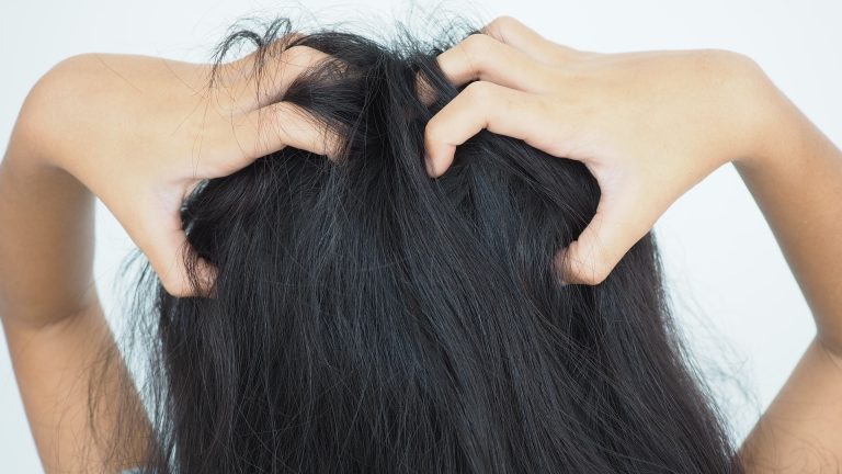 Why Castor Oil Won’t End Your Child’s Head Lice