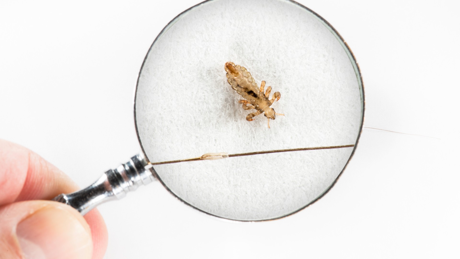 Head louse and nit on a hair strand viewed through a magnifying glass