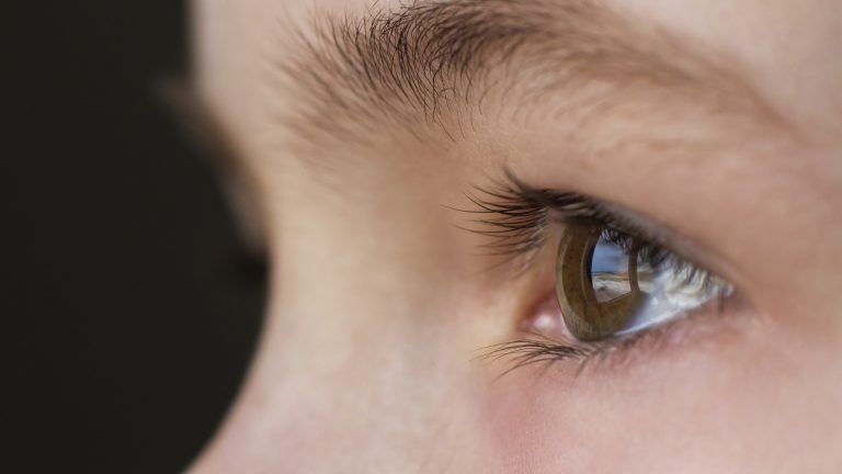 Eyelash Nits Are the One Spot a Lice Comb Cannot Fix