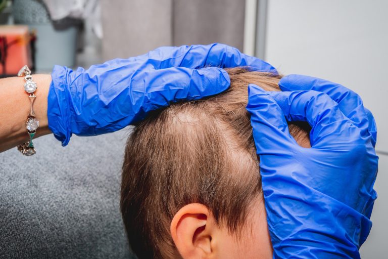 On Blonde Hair, the Nit You Can See Is Already Empty