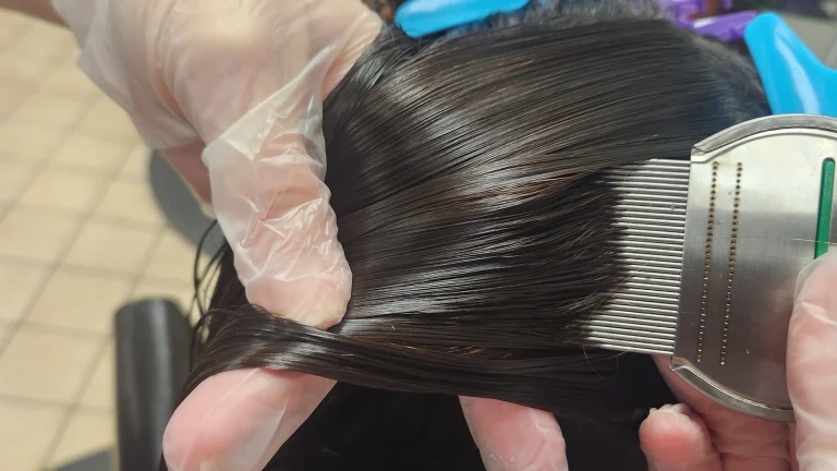 A Lice Comb Beats a Black Light for Toms River Lice Checks